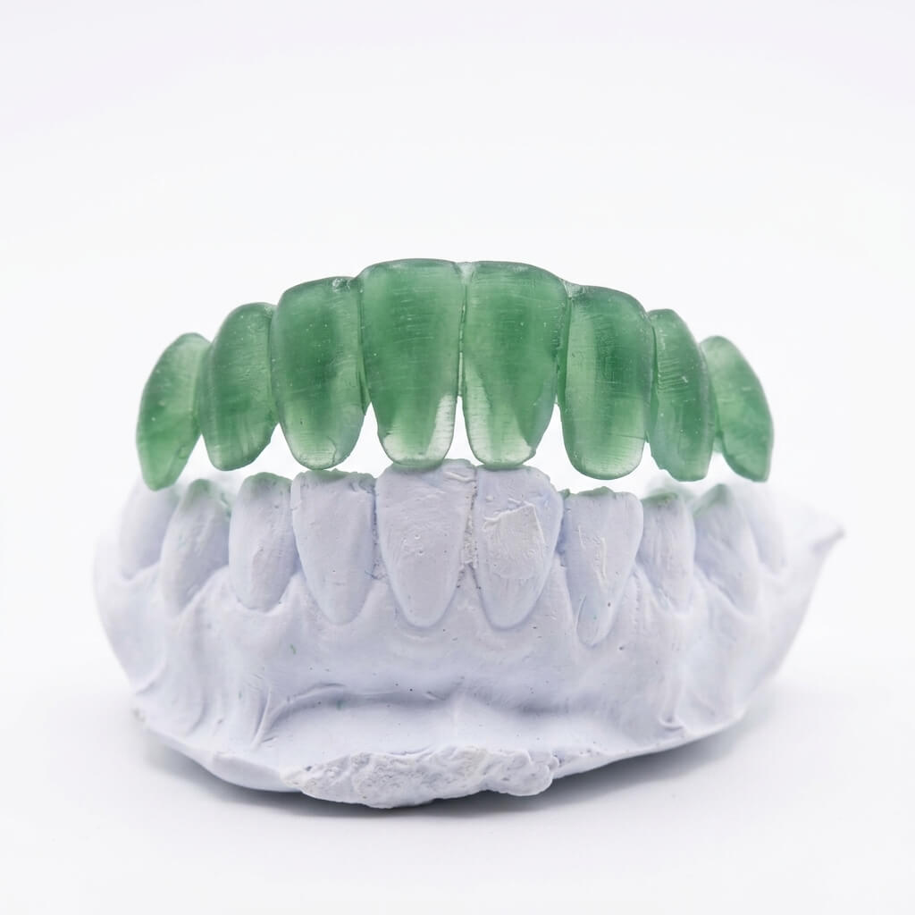 Custom Grillz Deposit + Mold Kit