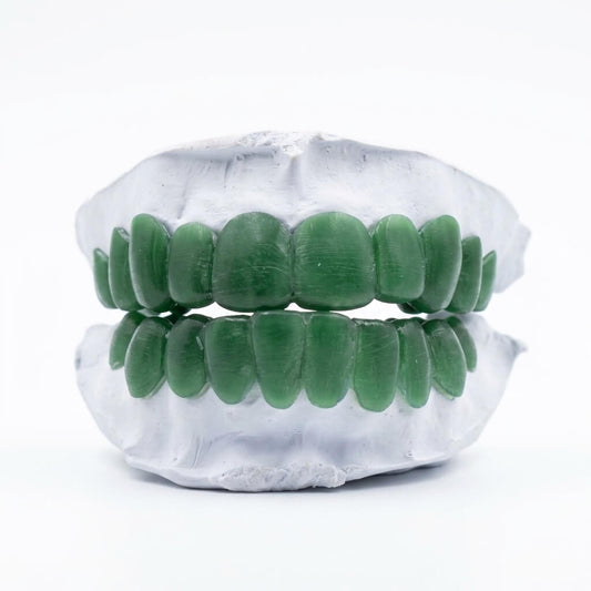 Custom Grillz Deposit + Mold Kit