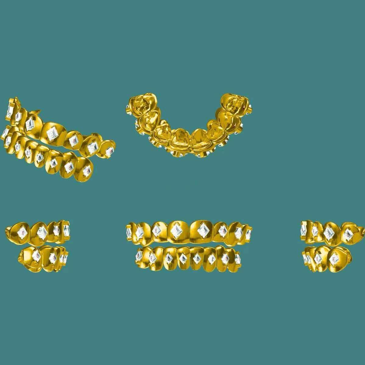 Custom Grillz Deposit + Mold Kit
