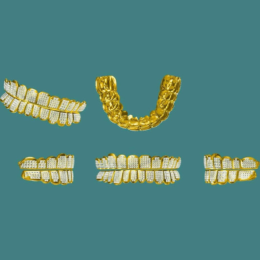 Custom Grillz Deposit + Mold Kit