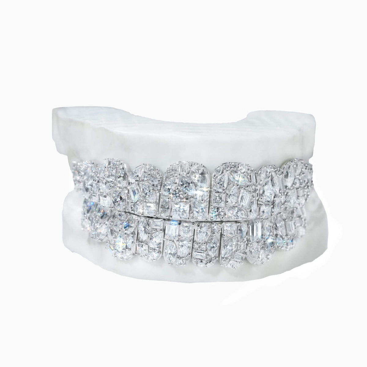 Custom 10 on 10 Iced Out Mixed-Cut VVS Moissanite Grillz – 14K Gold