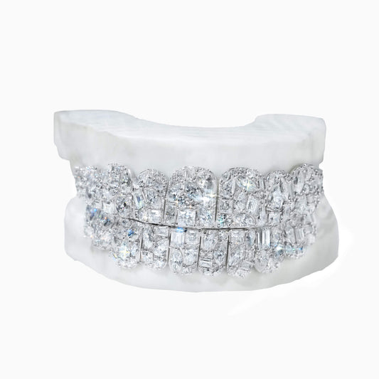 Custom 10 on 10 Iced Out Mixed-Cut VVS Moissanite Grillz – 14K Gold