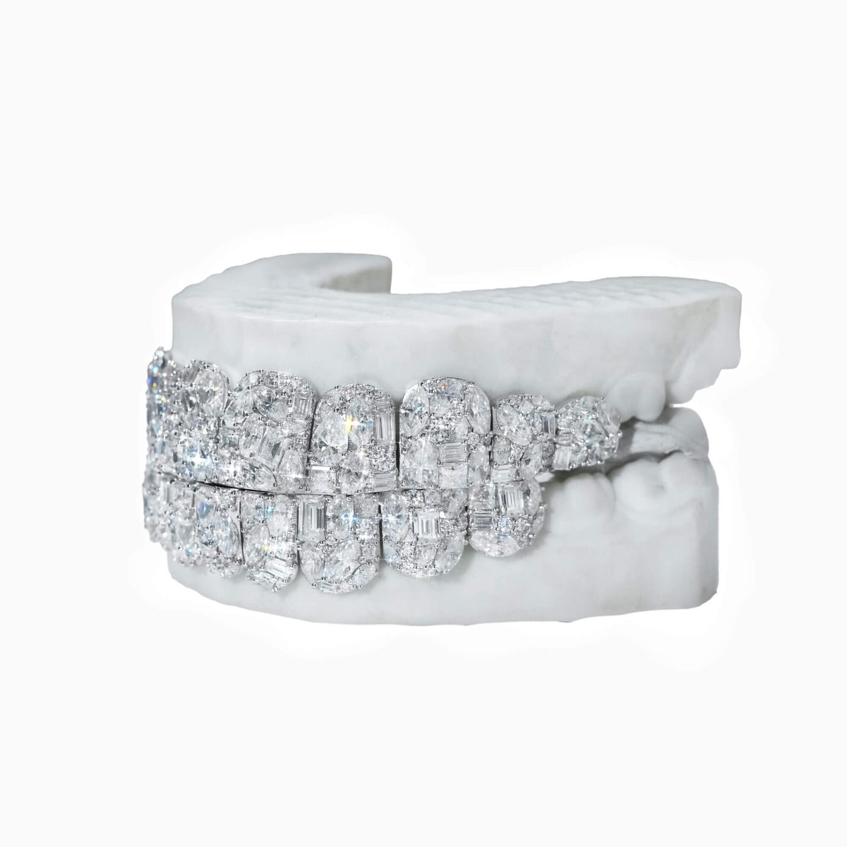 Custom 10 on 10 Iced Out Mixed-Cut VVS Moissanite Grillz – 14K Gold