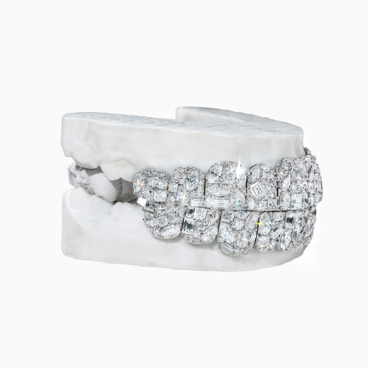 Custom 10 on 10 Iced Out Mixed-Cut VVS Moissanite Grillz – 14K Gold